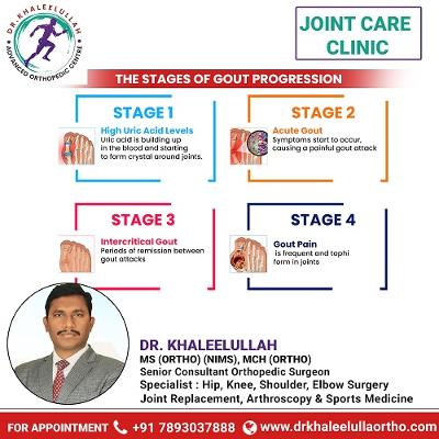 The Stage of Gout Progression